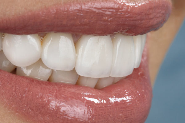 estética clínica dental
